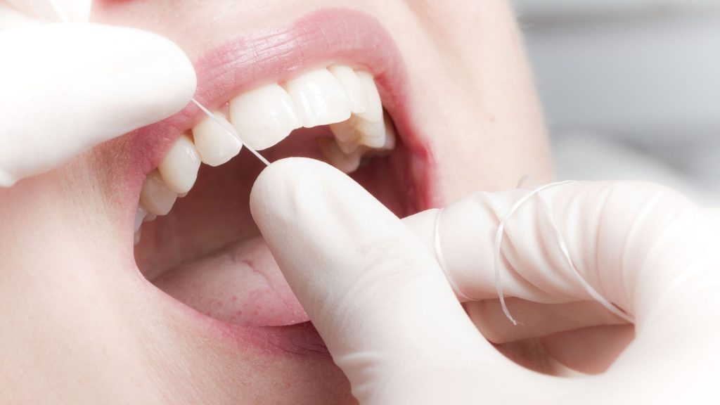 Zähne gesund halten mit Zahnseide